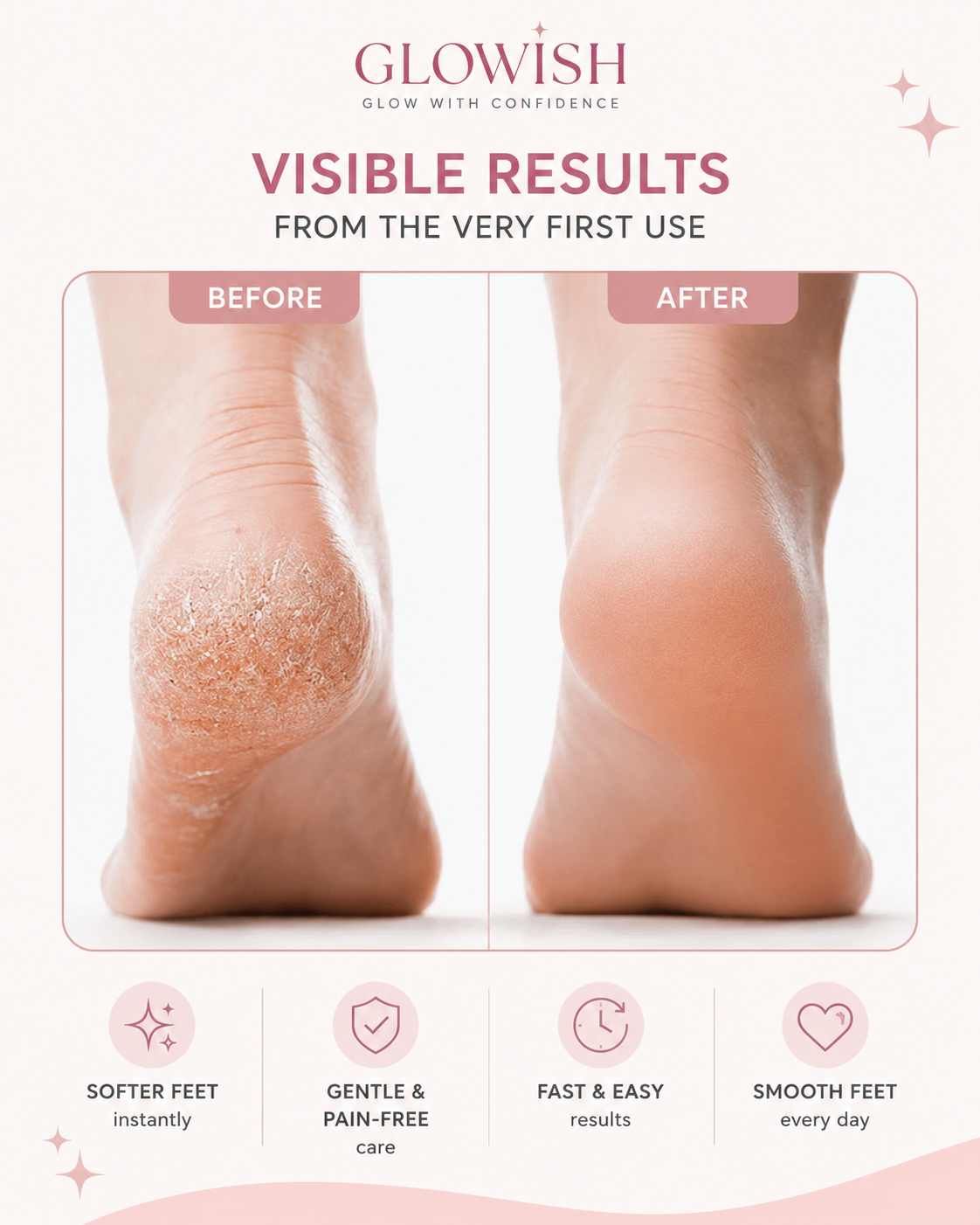 Glowish™ - Electric Callus Remover